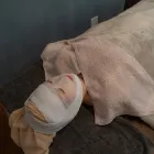 フェイシャル